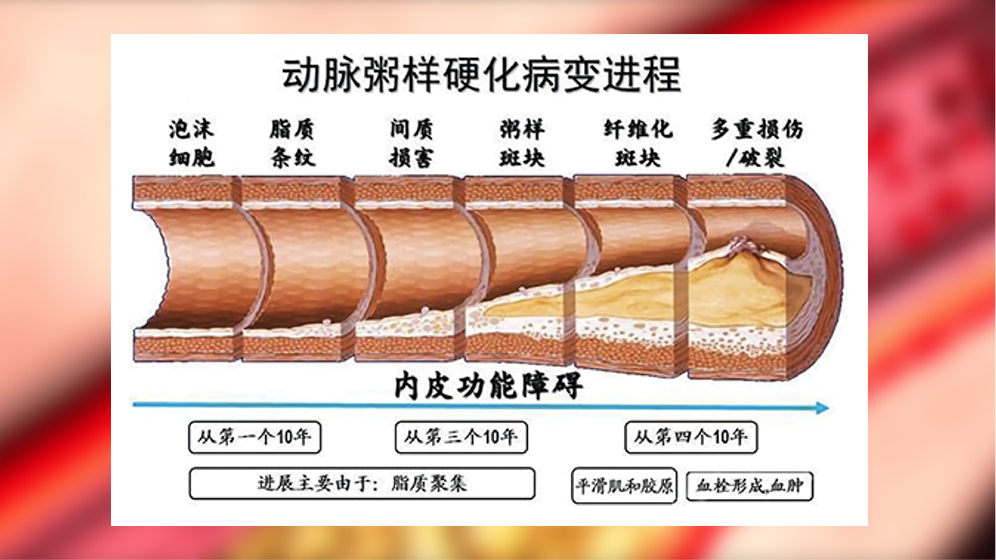 发病机制示意图
